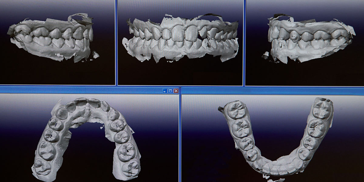 screenshots of digital x-ray images