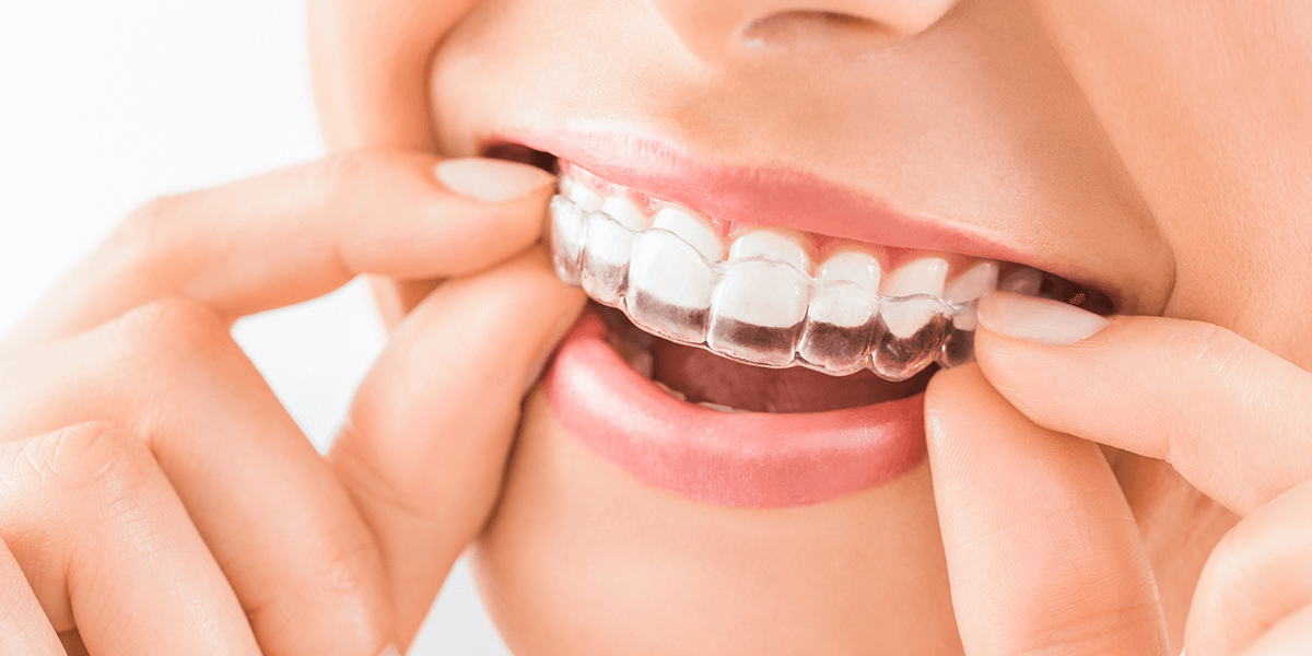 Germantown Invisalign Provider