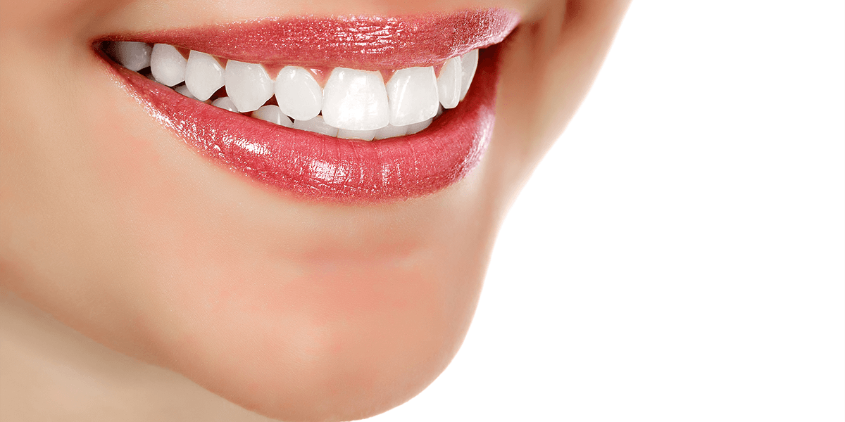 Smile Makeover Decorative Photo